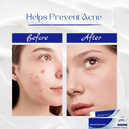 Top Sellers Duo: Vitamin A Pommade / Ialuset Hyaluronic Acid Anti-Wrinkle Cream